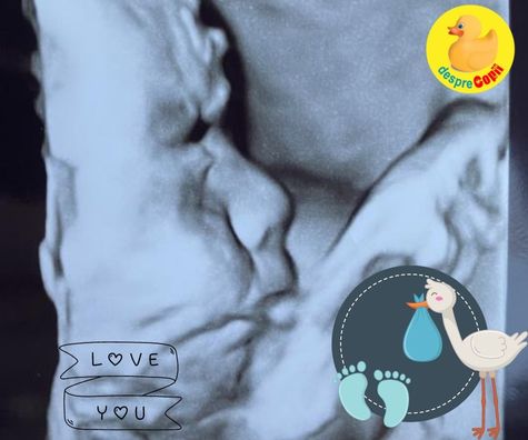 Ecografia din saptamana 28 de sarcina: am un bebe rusinos - jurnal de sarcina